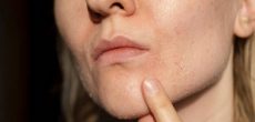 Cách Dưỡng Da Mùa Đông Để Không Bị Khô, Bong Tróc